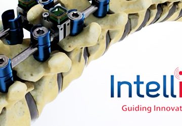 Intellirod Spine