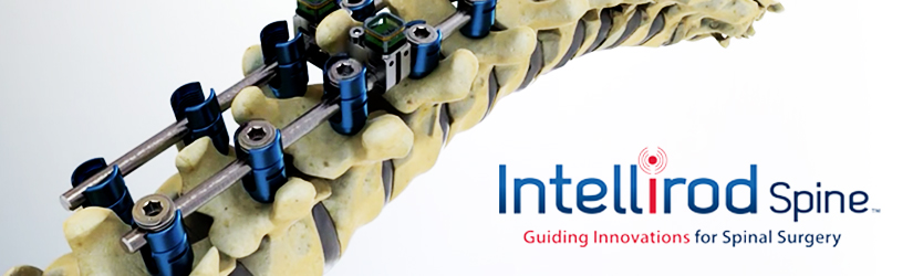 Intellirod Spine